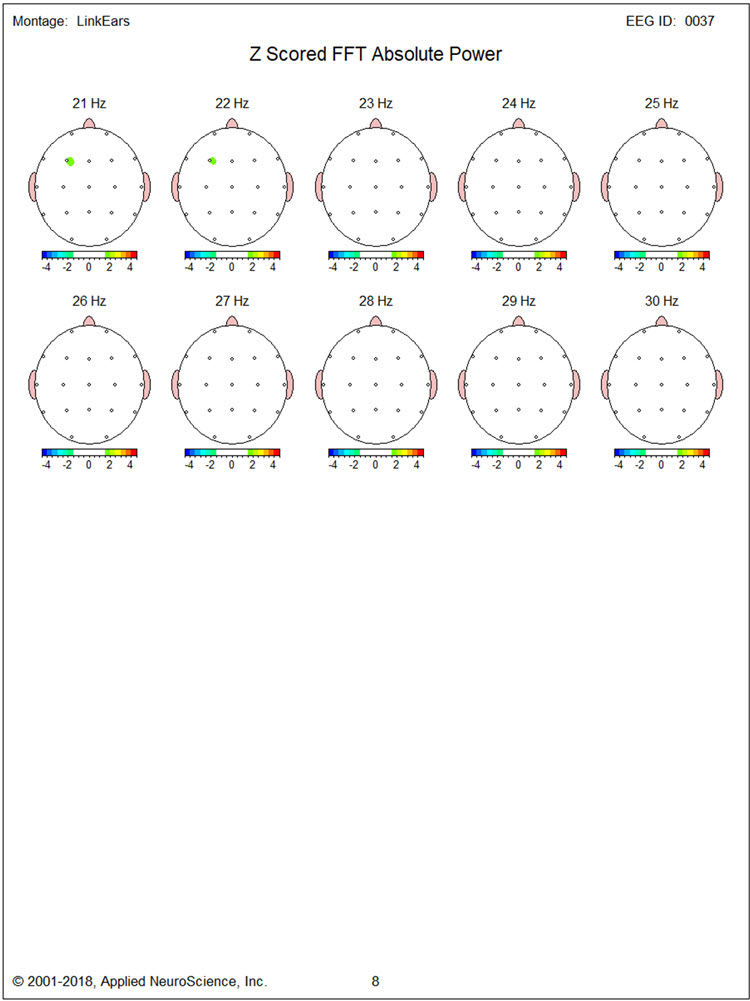 Figure 25 - Post-neurofeedback eyes-open z-score FFT absolute power single-Hz bins 21-30 Hz